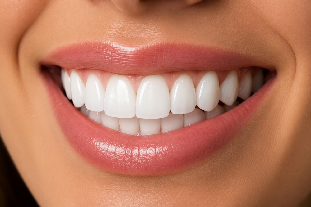 hollywood smile