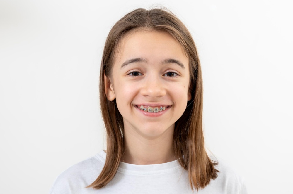 Çocuk Ortodonti (Pedodontik Ortodonti) Nedir? Neleri Kapsar?